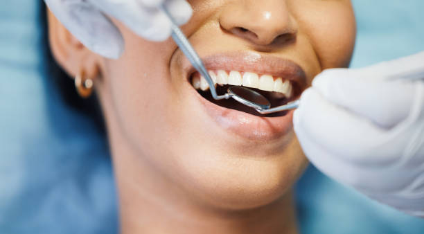 Best Dental Abscess Treatment in Duluth, GA