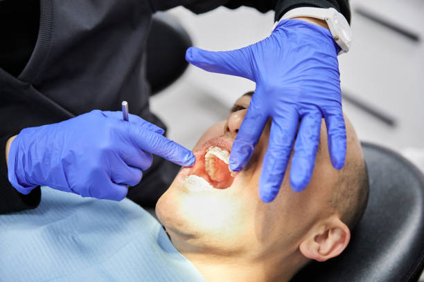 Best Knocked-Out Tooth (Avulsed Tooth) Treatment in Duluth, GA